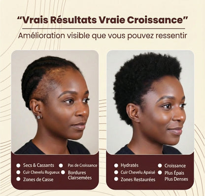 Huile de Batana Pure – L’Excellence de la Croissance Capillaire