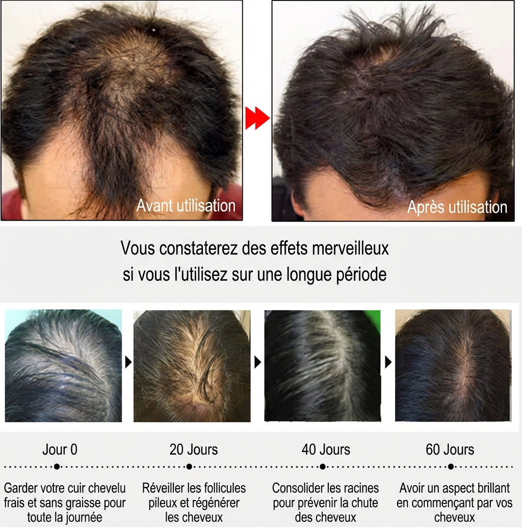 Sérum Croissance Capillaire à l’Huile de Batana